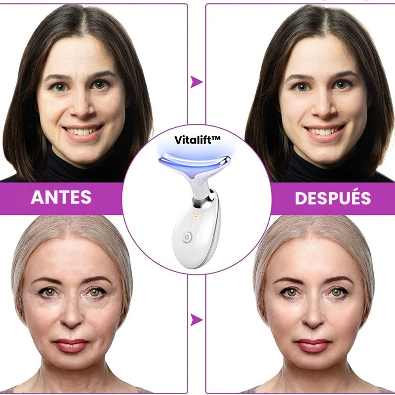 Masajeador facial antipapada CON LUZ LED - W.S